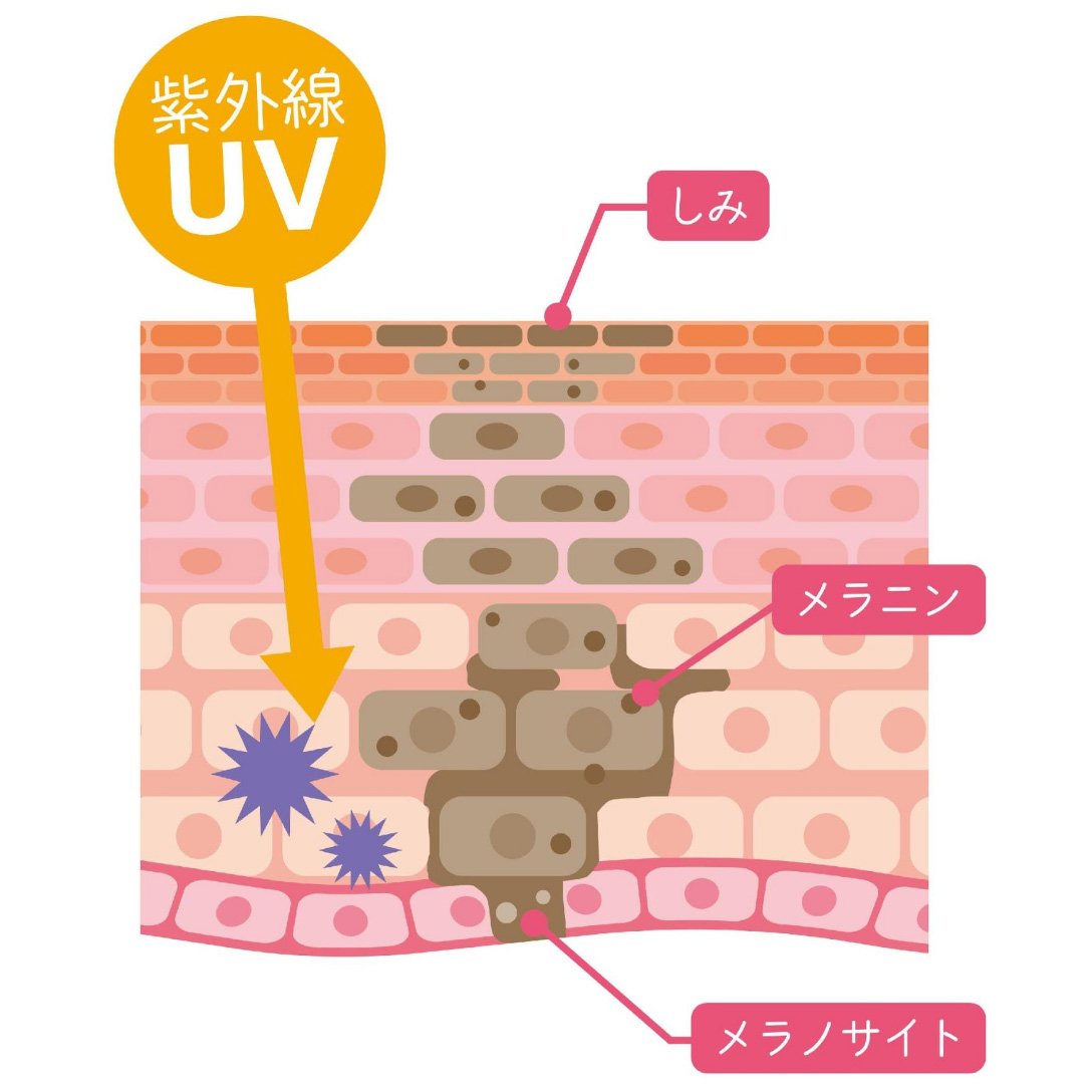 顔にできるメンズのシミの原因