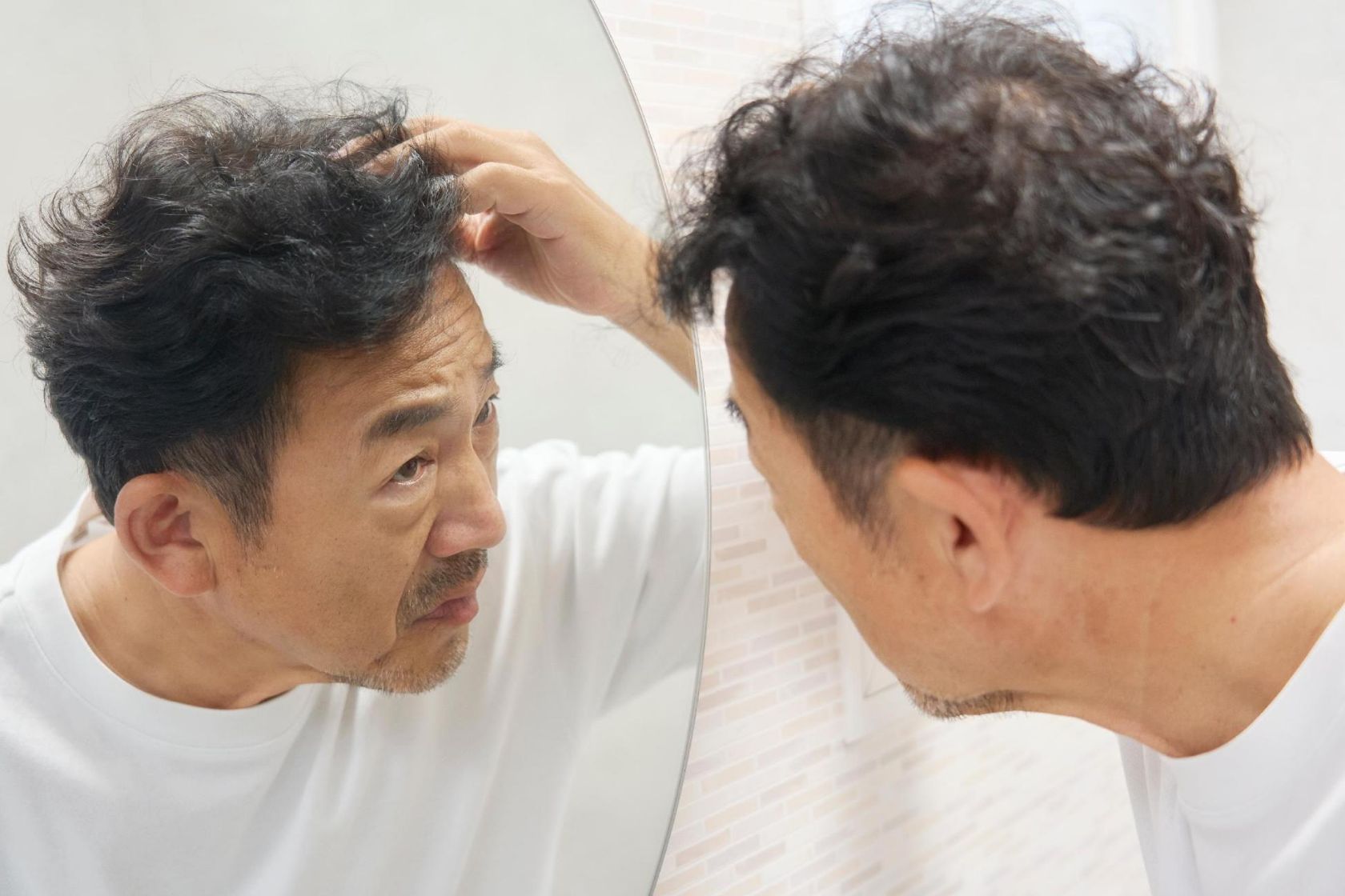 AGA(男性型脱毛症)の前兆