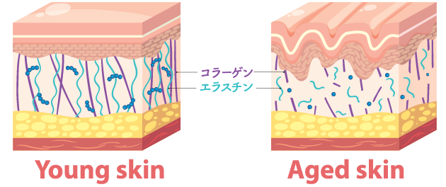 顔のたるみによって疲れて見える