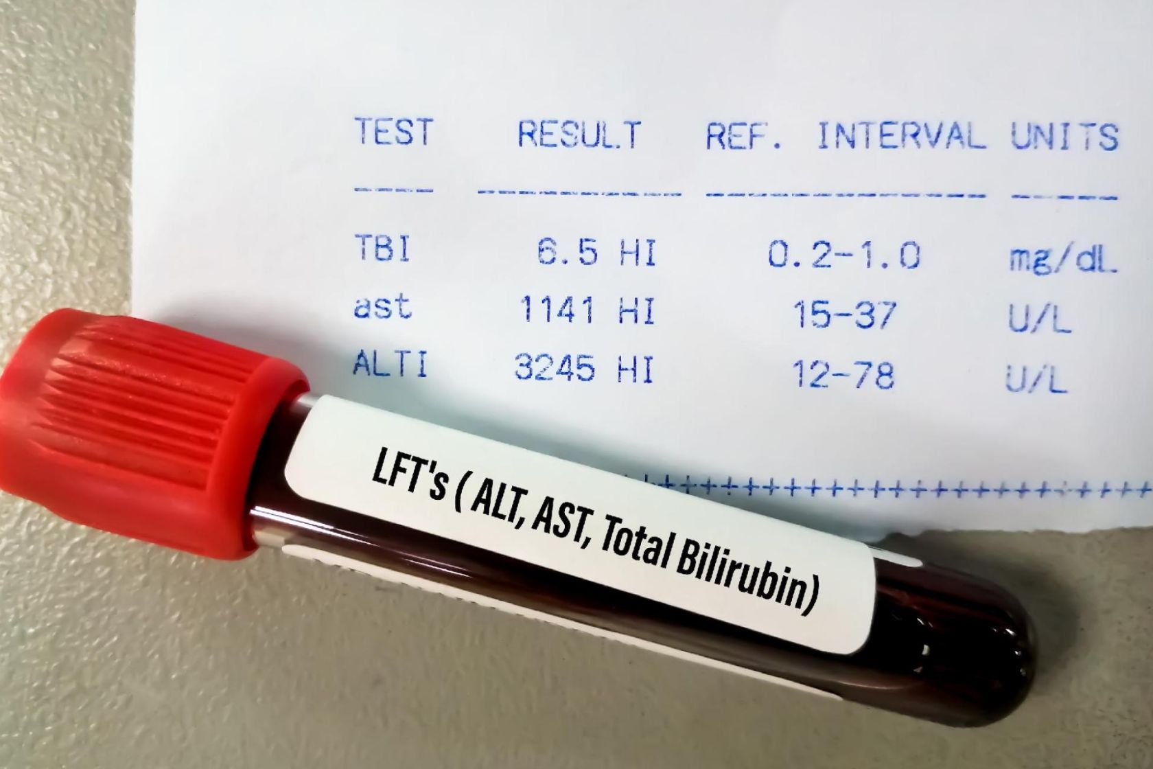 AST・ALTとは｜わかりやすく解説